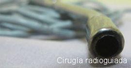Cirugía radioguiada Cirugía radioguiada